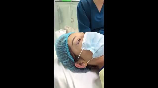 Phục hồi mí lỗi đã cắt sửa Spa tới 3 lần…