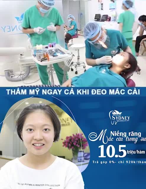 PHƯƠNG PHÁP NIỀNG RĂNG THẨM MĨ TIẾT KIỆM NHẤT