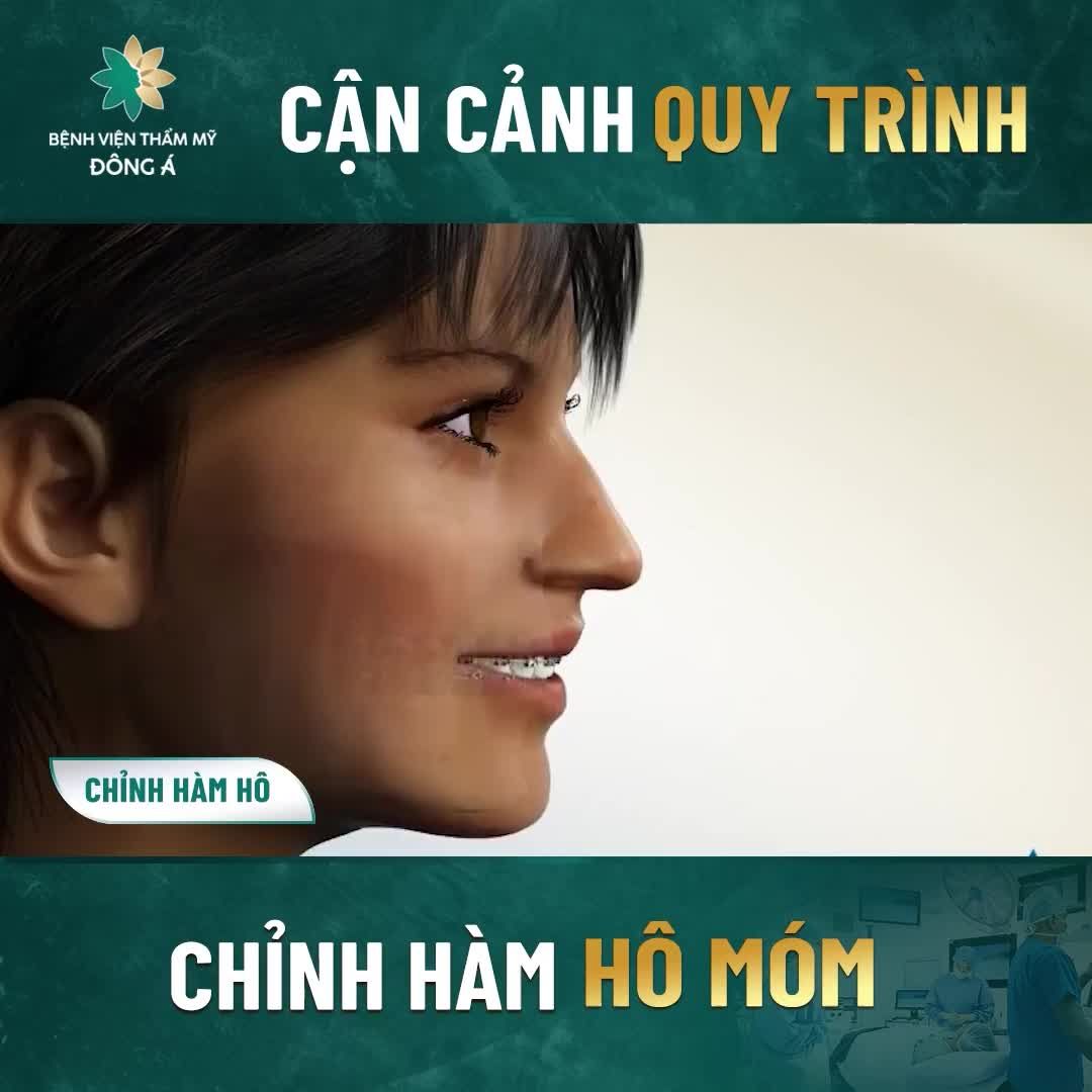 QUY TRÌNH CHỈNH HÀM cực chi tiết
