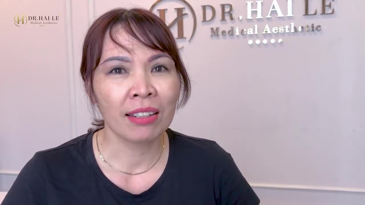 REVIEW KẾT QUẢ NÂNG CUNG MÀY