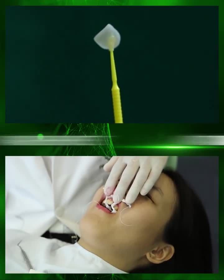 Sao Việt và rất nhiều khách hàng đã chọn Nha khoa Gia Đình để thay đổi nụ cười, còn bạn thì sao? Inbox đặt lịch ngay để được tư vấn tốt nhất.