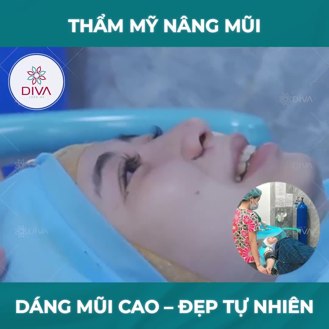SAY "BYE" SỐNG MŨI THẤP, CÁNH MŨI TO BÈ: CÔ NÀNG SỞ HỮU DÁNG MŨI MỚI CAO HÀI HÒA, THANH THOÁT SAU THẨM MỸ