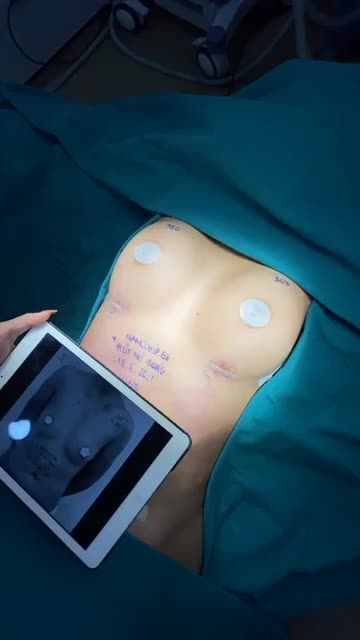 SIÊU PHẨM "KIẾN TẠO" BODY THỰC HIỆN BỞI EKIP SLINE SAU 180 PHÚT
