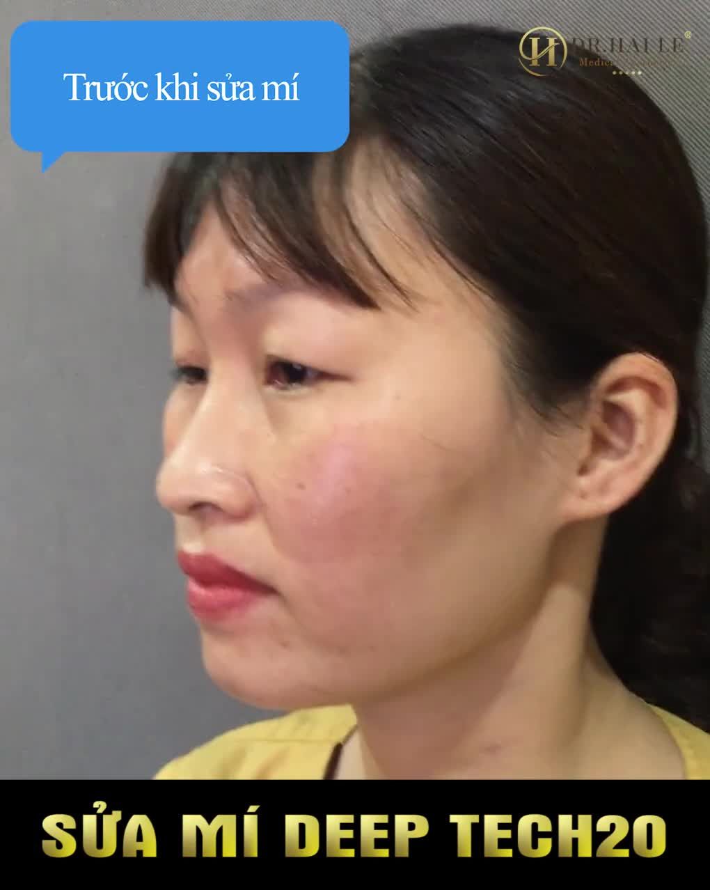 "Sửa mí xong nhẹ hẳn cả người...."