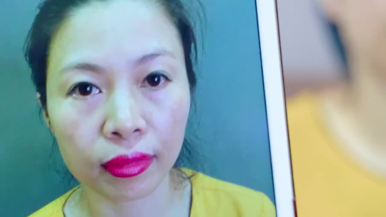 SỤP MÍ TUỔI TRUNG NIÊN GIẢI PHÁP NÀO HIỆU QUẢ NHẤT HIỆN NAY