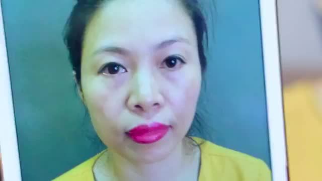 Sụp mí tuổi U30++ gây nặng mắt, u buồn, già nua, che khuất tầm nhìn Khắc phục như thế nào? Mời quý khách hàng cùng theo dõi video sau đây