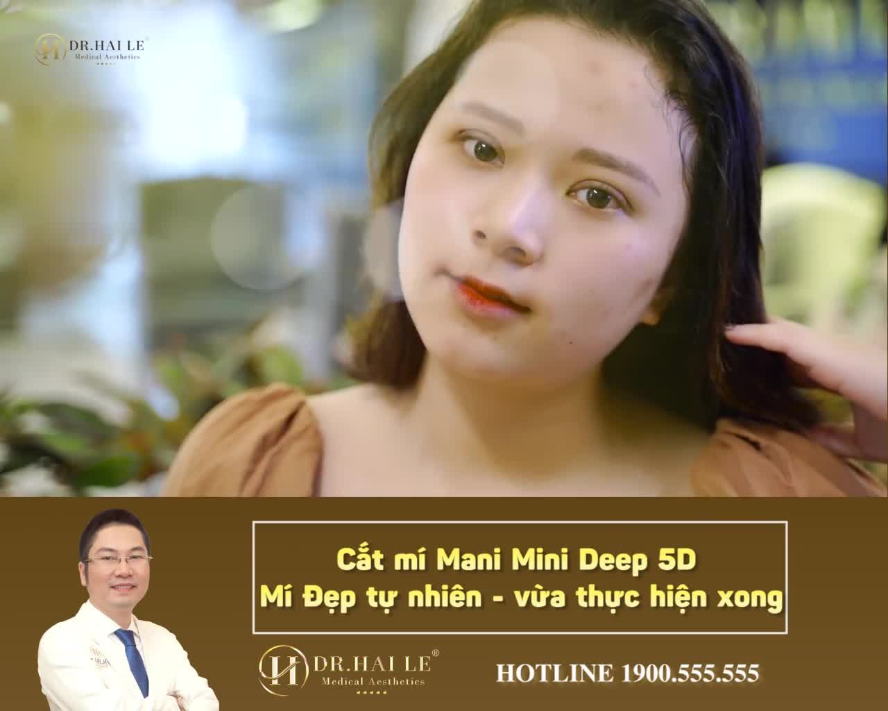 Tại sao Cắt mí Mani Mini Deep 5D - Cắt mí không sưng - không đau - mí đẹp tức thì - Hiệu quả dài lâu ???