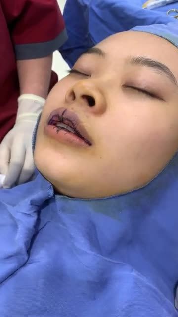 Tạo hình MÔI TIM: Kangnam làm CHUẨN từ khâu ĐO VẼ!!