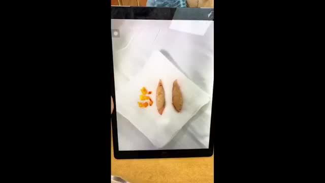 Tạo hình treo cung mày giúp vị khách hàng trẻ đẹp chỉ sau 30’ thực hiện Thẩm Mỹ Như Hoa Bác Sĩ Tống Hải