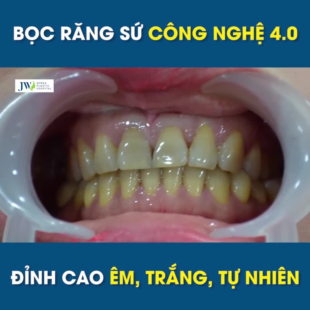 Trùng tu nụ cười rạng rỡ hơn Ưu đãi giảm đến 30%.