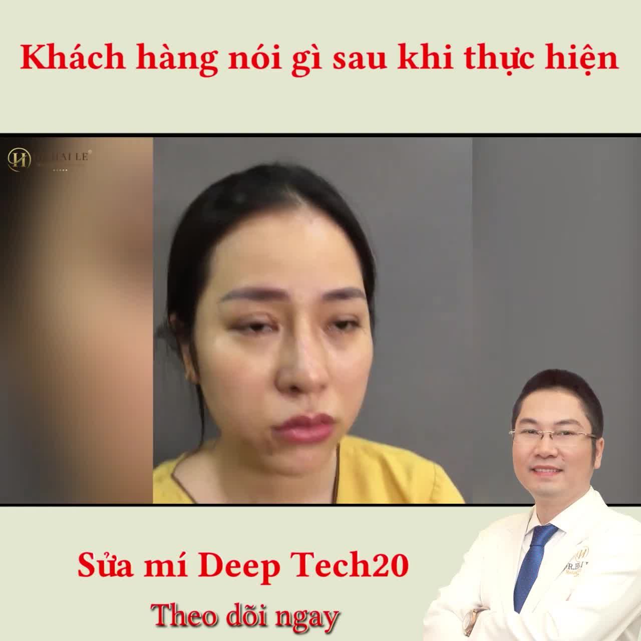 Từ ngày cắt mí bị hỏng em chưa từng dám up ảnh mình lên mạng xã hội...