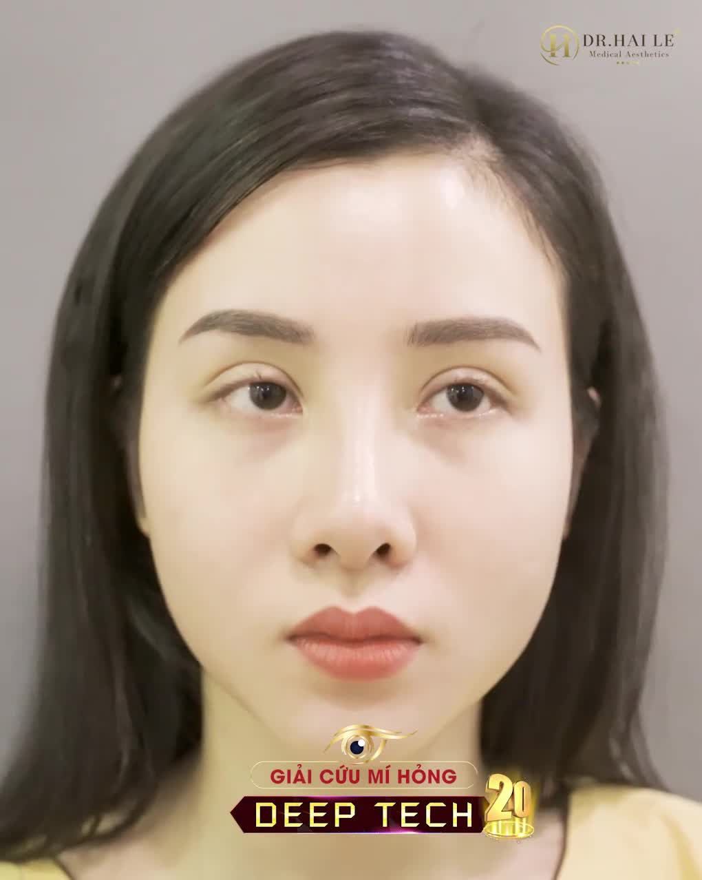 Tus Dành riêng cho khách hàng Mí hỏng