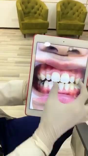 Vượt 750km từ Huế ra Hà Nội để thay đổi nụ cười Động lực nào khiến khách hàng di chuyển quãng đường xa như vậy và lựa chọn Delia?