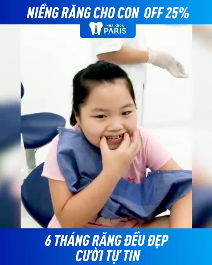 12 đến 18 tuổi ĐỘ TUỔI VÀNG niềng răng cho con