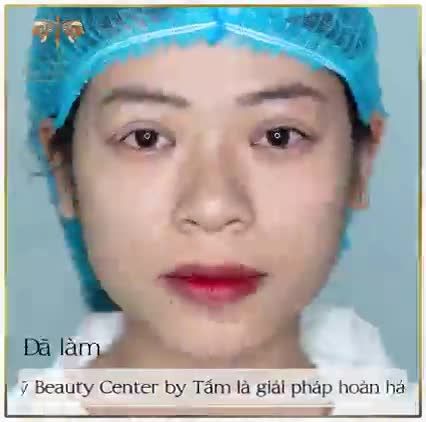 4 LÝ DO KHÁCH HÀNG CHỌN NGAY BẤM MÍ TẠI THẨM MỸ BEAUTY CENTER BY TẤM.