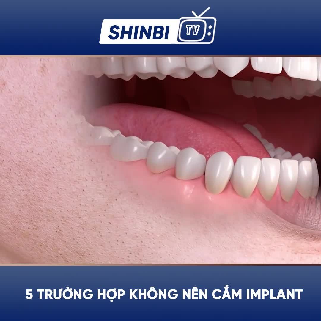 5 đối tượng không nên cắm implant