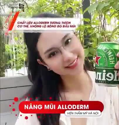 5 ƯU ĐIỂM NỔI BẬT CỦA NÂNG MŨI BỌC ALLODERM CÙNG TIẾN SĨ MAI MẠNH TUẤN