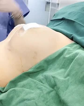 50 Tuổi và DÁNG NGỰC MỚI ĐẸP MỘNG MƠ