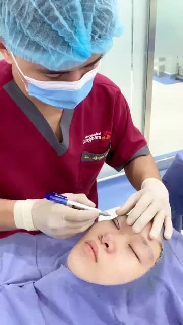 Bác sĩ Kangnam chia sẻ về combo nâng mũi - chỉnh hình sụp mí