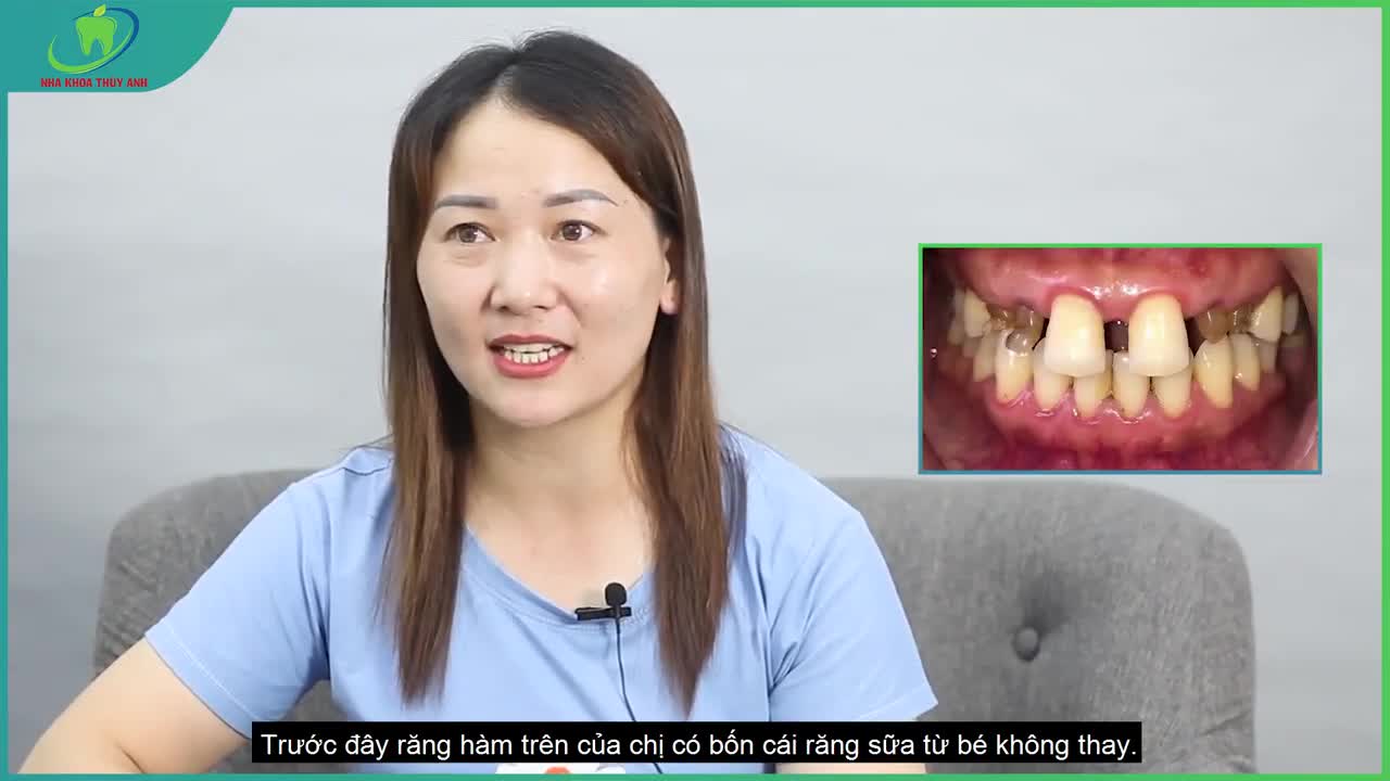 "BÓC TRẦN SỰ THẬT SAU 1 NĂM LÀM RĂNG SỨ THẢM MỸ