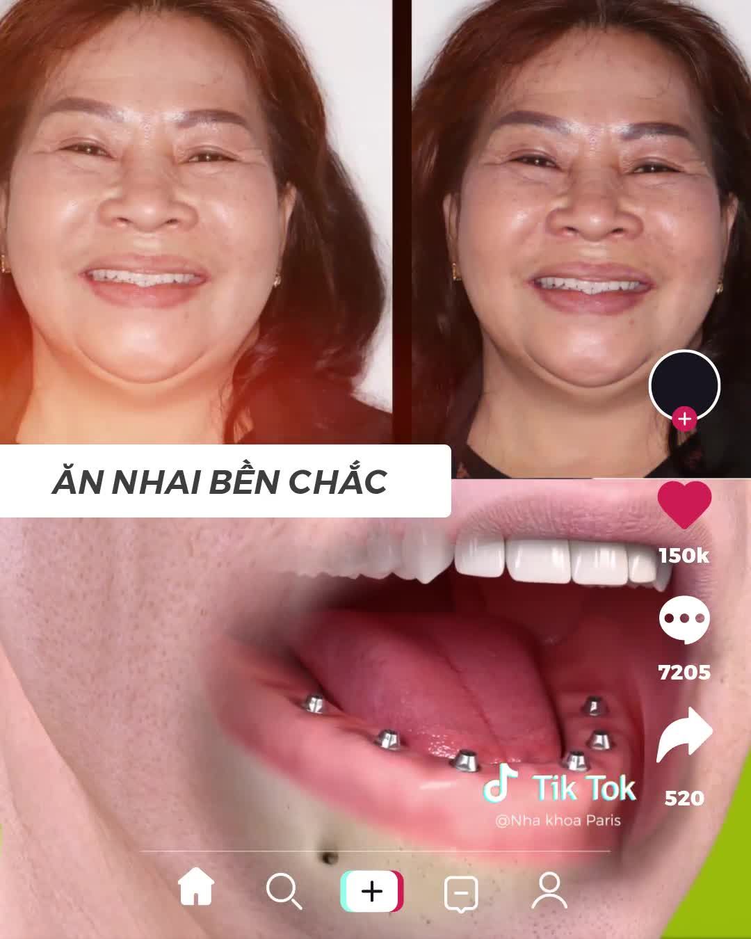 BS 20 năm kinh nghiệm khôi phục răng toàn hàm
