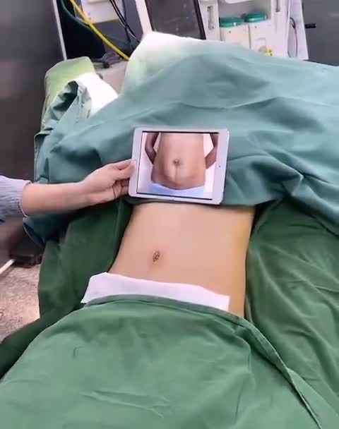 BS Tươi không những làm ngực tuyệt vời mà làm bụng cũng đẹp vô cùng mọi người nhé.