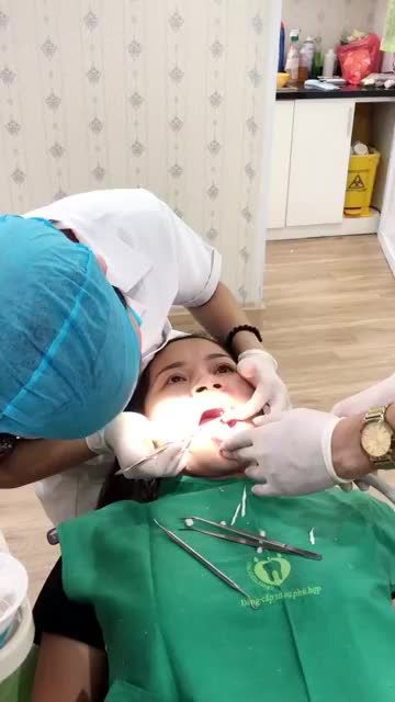 BS.CKI VŨ BÍCH DIỆP LẮP RĂNG SỨ CHO MỘT VỊ KHÁCH HÀNG