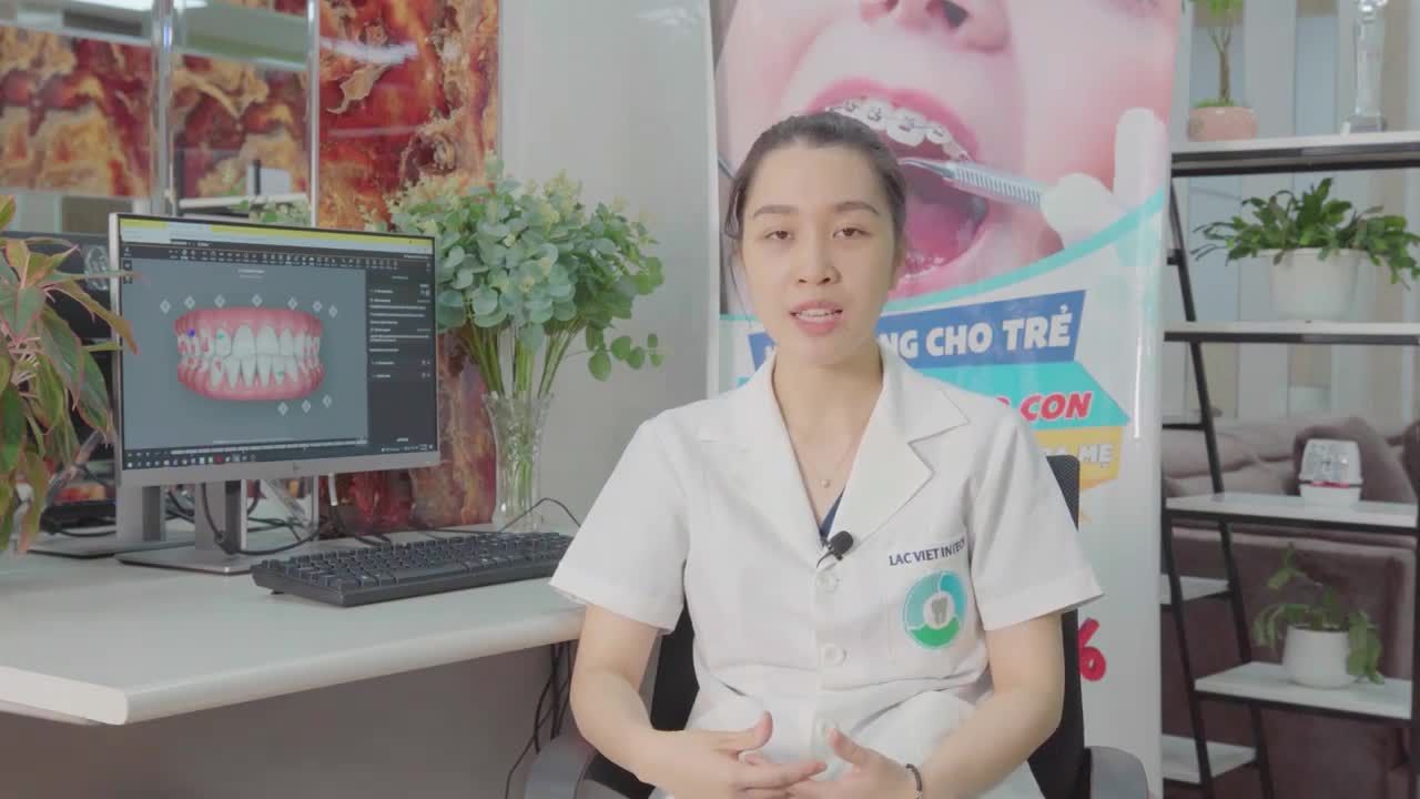 CA NIỀNG RĂNG KHE THƯA - XÔ LỆCH BẰNG MÁNG INVISALIGN THÀNH CÔNG TẠI LẠC VIỆT INTECH