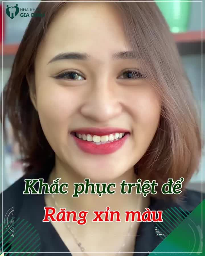 CẦN GẤP NHỮNG HÀM RĂNG CỰC XẤU ĐỂ TRỢ GIÁ TỚI 65%