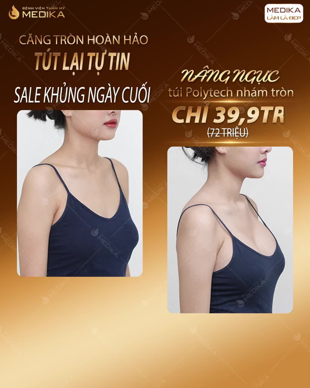 CĂNG TRÒN HOÀN HẢO – TÚT LẠI TỰ TIN