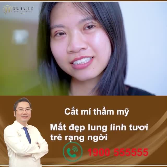 CẮT MÍ thẩm mỹ Dr.Hải Lê HƯỞNG TRỌN ĐÔI MẮT 2 MÍ RẠNG NGỜI TƯƠI TRẺ với chi phí siêu ưu đãi, chỉ từ 6tr8