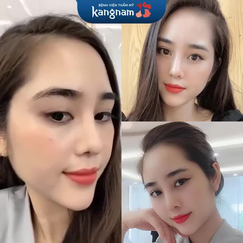 Chỉ một thay đổi nhỏ đã giúp nàng lễ tân nhà Kangnam hóa "nàng thơ"