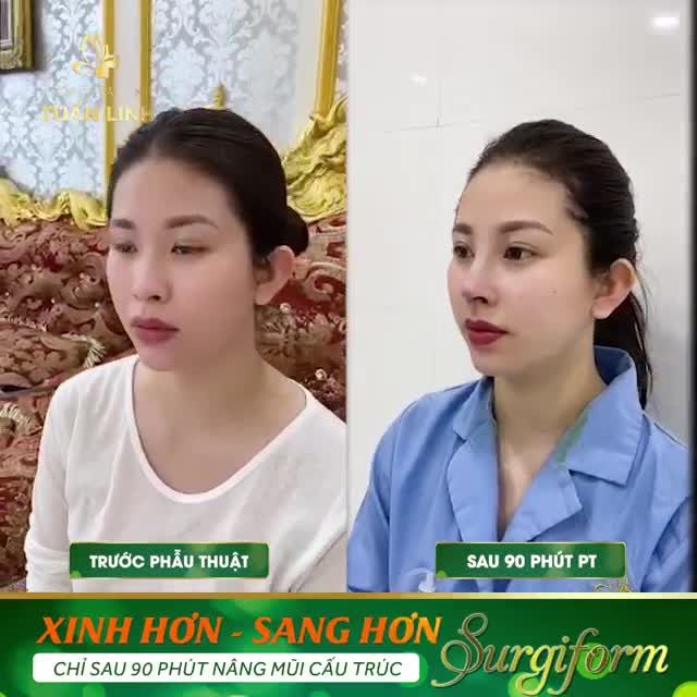 Chiếc mũi cao giống như ''ma thuật'' giúp khuôn mặt xinh sang và thu hút hơn trong giao tiếp.