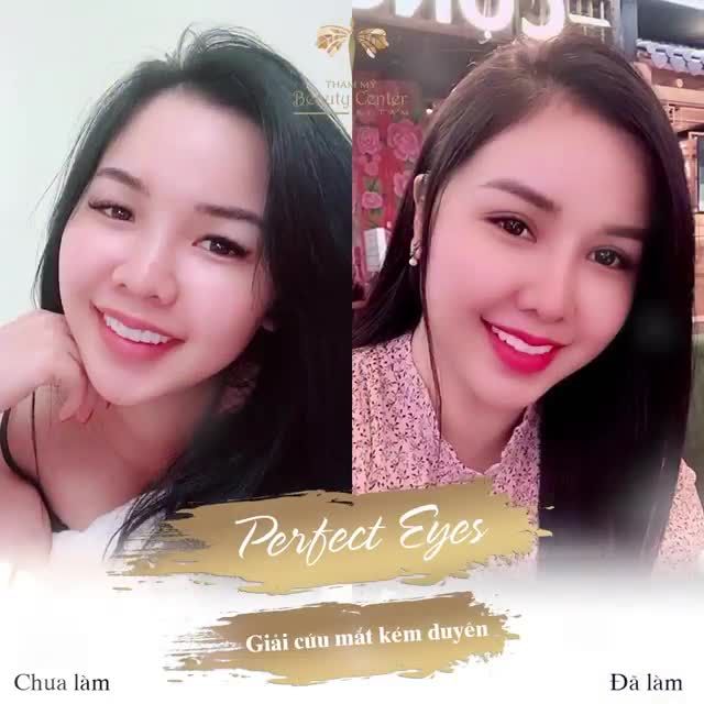 CHIÊM NGƯỠNG MẮT ĐẸP CỦA LOẠT KHÁCH HÀNG HOTGIRL