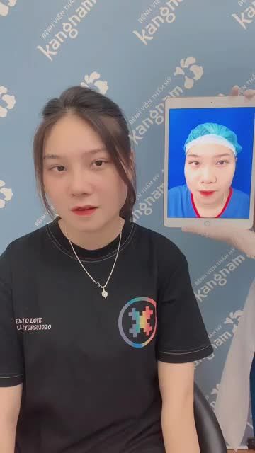 Chọn 1 đời MŨI THẤP hay MŨI CAO SANG cả đời?