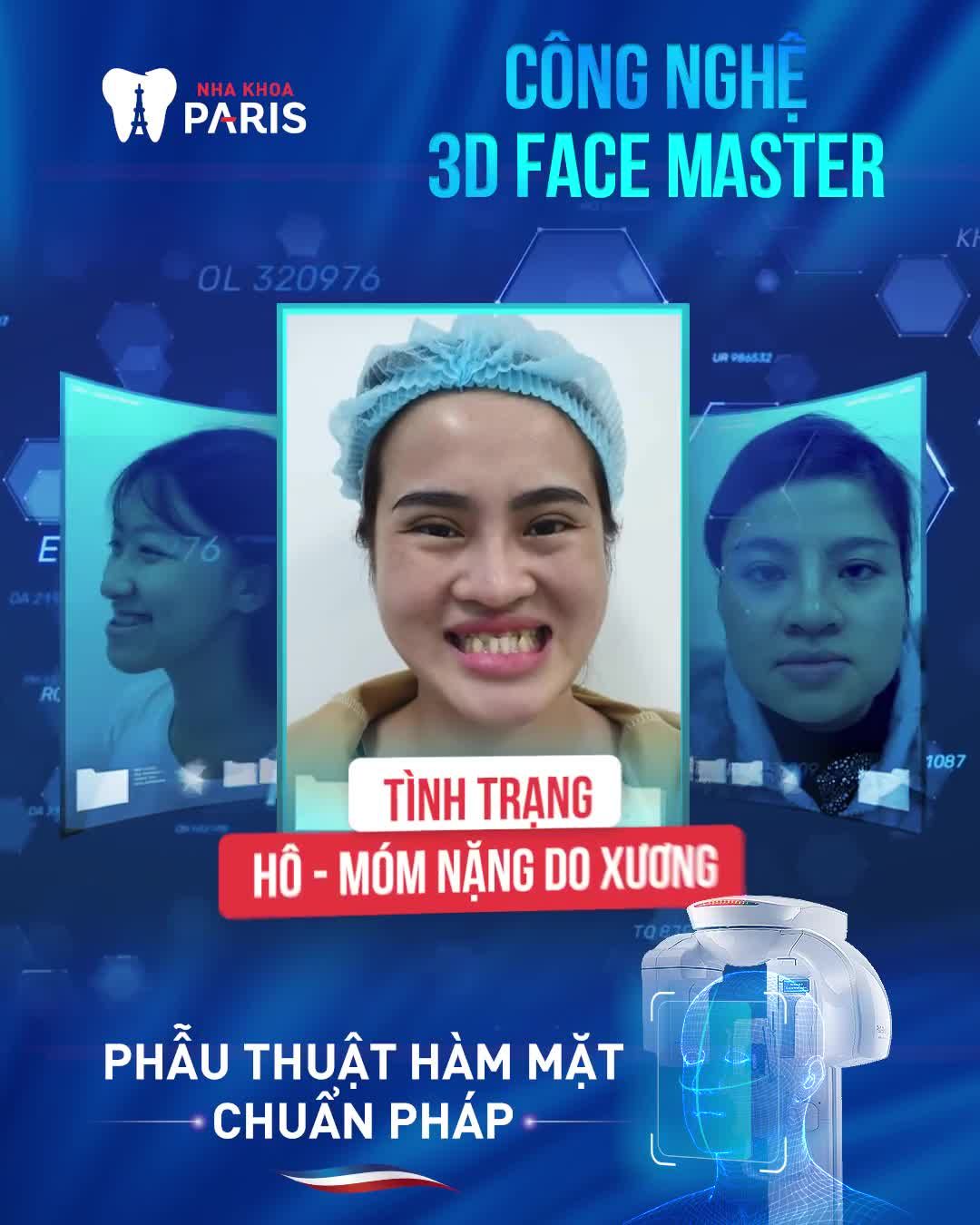 Công nghệ 3D tái tạo gương mặt đa chiều, chính xác từng milimet.