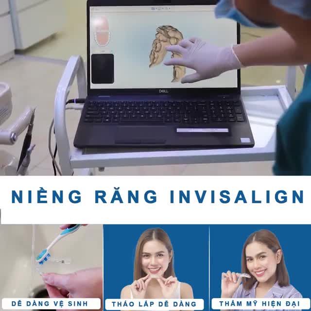 Công nghệ niềng răng invisalign