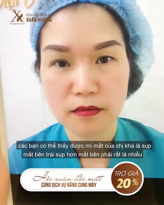 CỨU CÁNH ĐÔI MẮT "GIÀ NUA" KHỎI NHỮNG DẤU HIỆU LÃO HÓA NÂNG CUNG MÀY XONG TRẺ RA CẢ CHỤC TUỔI