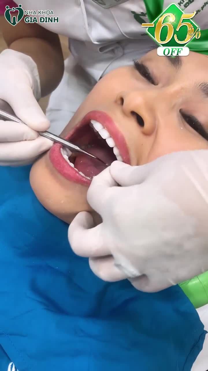 DỄ DÀNG CÓ MỘT NỤ CƯỜI ĐẸP KHI ĐẾN VỚI NHA KHOA GIA ĐÌNH