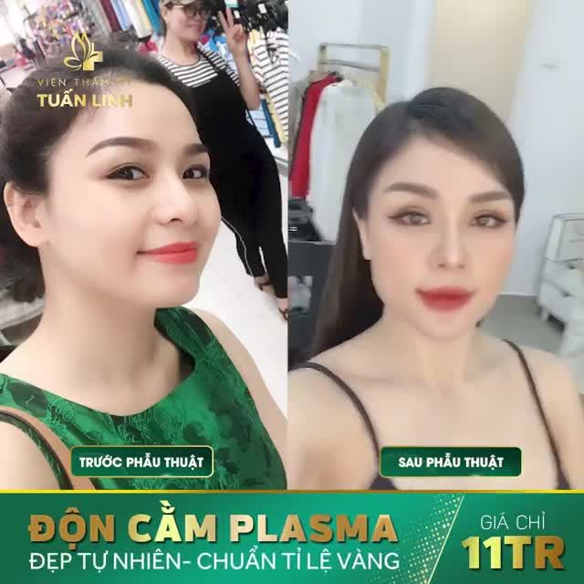 ĐỘN CẰM CÔNG NGHỆ PLASMA