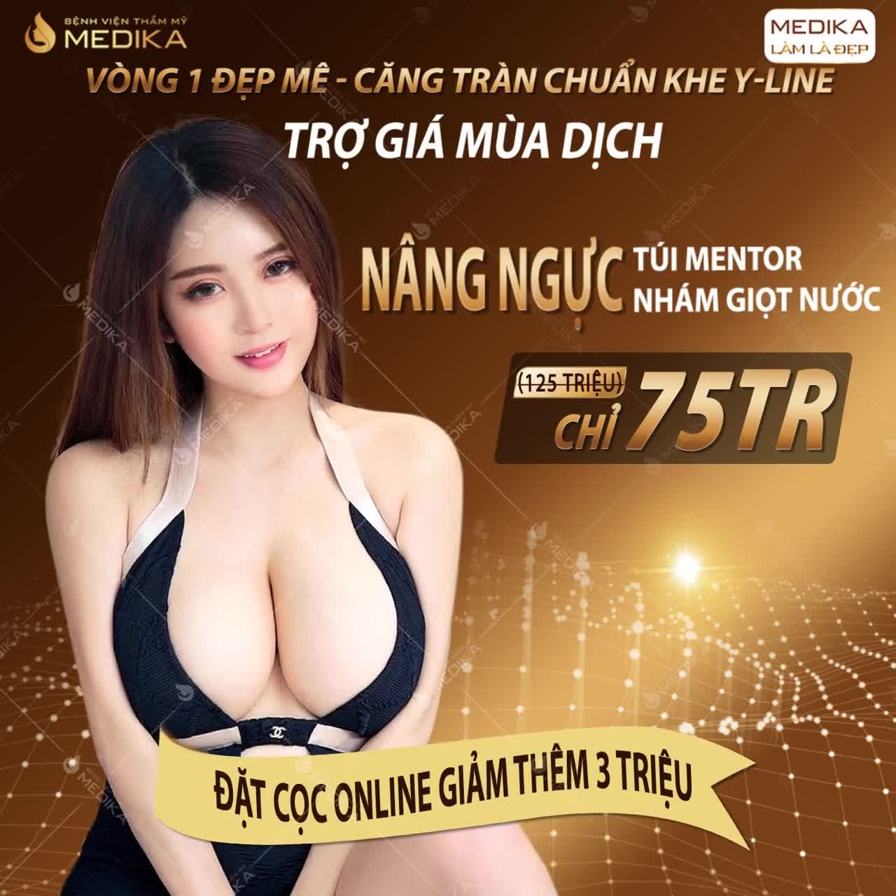 Dòng túi Mentor nhà MEDIKA luôn nhận được sự ưu ái từ phái đẹp khi nâng ngực.