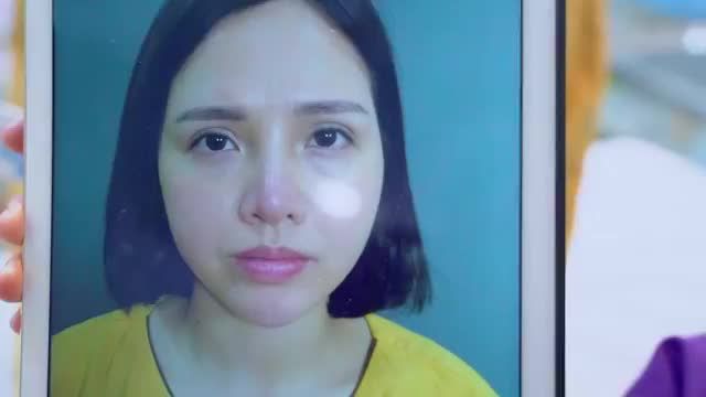 Đừng ai để mình rơi vào tình cảnh "mí lỗi hỏng", bạn khách trẻ trung sau khi lầm lỡ cắt mí tại cơ sở thiếu uy tín đã may mắn được giải cứu tại Dr.Hải Lê.
