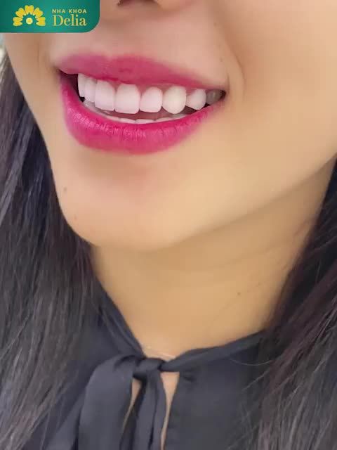 ĐỪNG NGẠI CƯỜI MÀ HÃY TRỞ THÀNH PHIÊN BẢN ĐẸP HƠN MỖI NGÀY