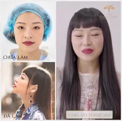 "Em cần chiếc mũi cao, đẹp căng đét"  Đến với Tấm trung tâm sẽ tạo nét cho em