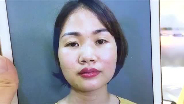 Gần 30 năm sở hứu mắt lệch to nhỏ và chỉ 45 phút để trở hữu mắt 2 mí to rõ nét... Khách hàng thay đổi như thế nào? Mời cả nhà cùng đón xem