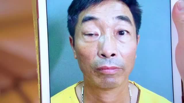 Gần 50 năm sống chung với đôi mắt sụp mí bẩm sinh, chưa từng thôi ý định sửa lại đôi mắt để có thể nhìn thấy mọi thứ quang đãng hơn, rõ ràng hơn