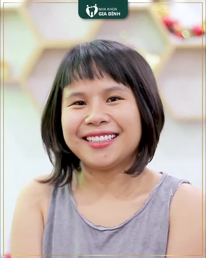 Giá nào chứ giá này thì chỉ ước “Giá như mình đi làm răng sớm hơn thì đã được đẹp như thế này rồi”!