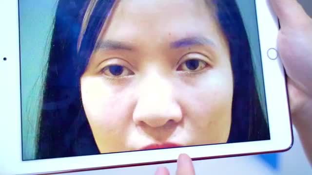 GIẢI CỨU MÍ HỎNG SAU PTTM 2 LẦN KHÔNG THÀNH CÔNG GIÚP EM GÁI LẤY LẠI TỰ TIN MẮT ĐẸP ĐÚNG NHƯ MONG ĐỢI