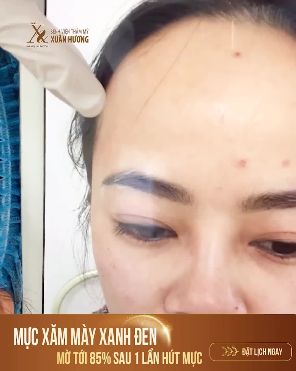 "GIẢI CỨU" MỰC XĂM MÀY ĐEN ĐẬM, MỜ TỚI 85% CHỈ SAU LẦN ĐẦU TIÊN