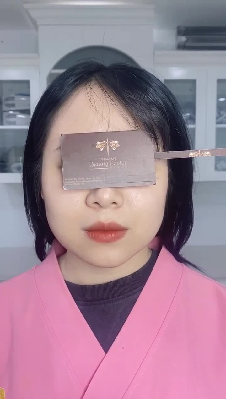 Hàm to chẳng còn là nỗi lo khi đã có Botox thon gọn hàm.